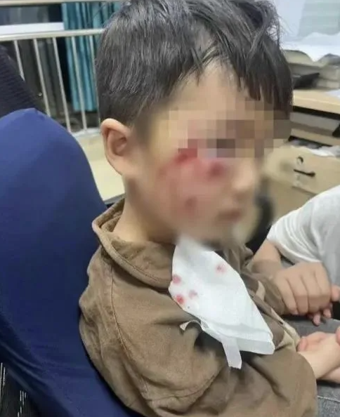 被瘋?cè)麤](méi)有“救命藥”，怎么辦？